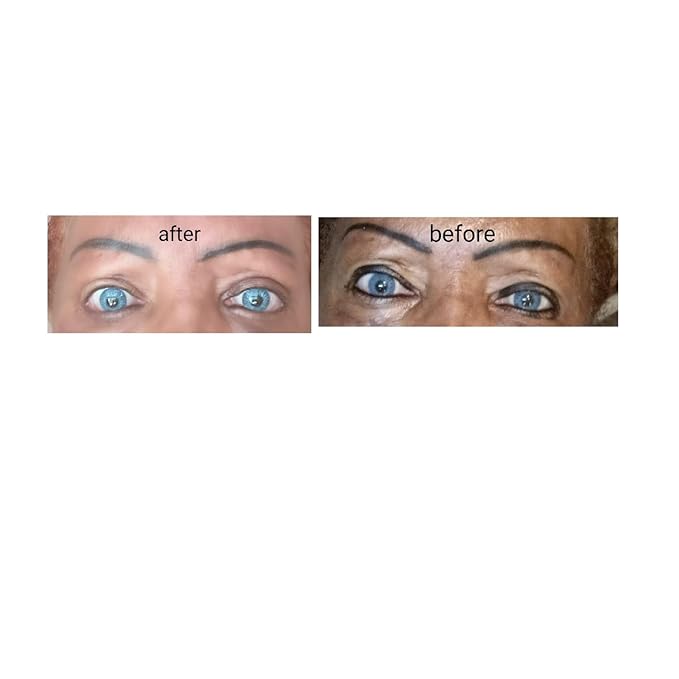 Brightnening Eye Serum with Niacinamide (vitamin B3). Powerful Eye Treatment Serum-Advanced Formula, Anti-aging, Visibly Rapid Wrinkle Reduction and Crow feet (30 ml)