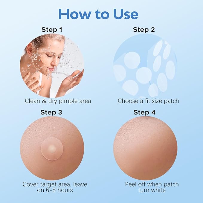 Large Pimple Patches for Face 331 Patches,Hydrocolloid Acne Patch Skincare Blemishes Zit Breakouts Bandages Big Spot Covers for All Skin Types w/Tea Tree Salicylic Acid & Cica Oil|Bigpack,Larger Size