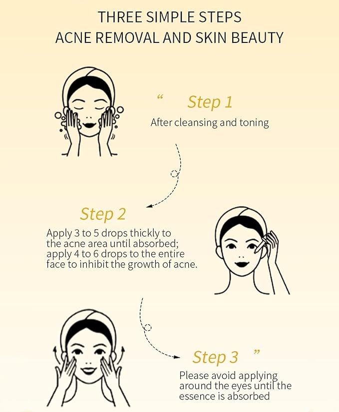 Propolis and Niacinamide Hydrating Facial Soothing Moisturizer, Glow Boosting Serum for Face for Acne-prone&Sensitive skin, Minimize breakouts, Korean skincare 30ml, 1 fl.oz