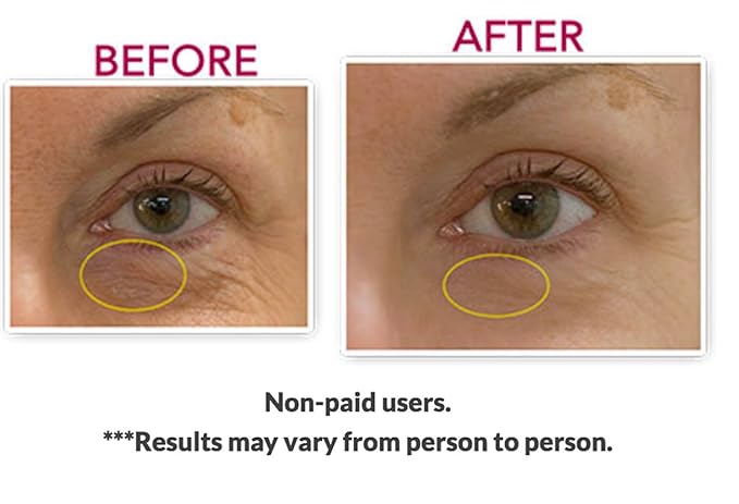 Skin Care 100% Solution Anti-Eye bag, Anti-Dark Circle, Anti-Puffy Eyes By Eyeseryl® Tetrapeptide Add To Your Eye Gel or Cream (0.5 OZ)