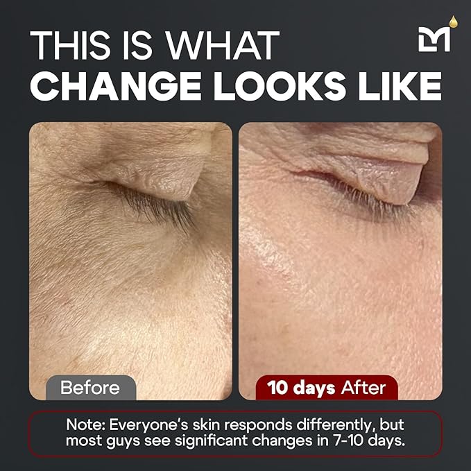 Man Labs Titan MAX Anti-Aging Peptides Serum for Face – Ultra Potency Mens Peptide Serum Moisturizer – Mens Skin Care – Men, Dark Spots, Wrinkles, Fine Lines – Peptides, 10% Niacinamide, HA –Unscented