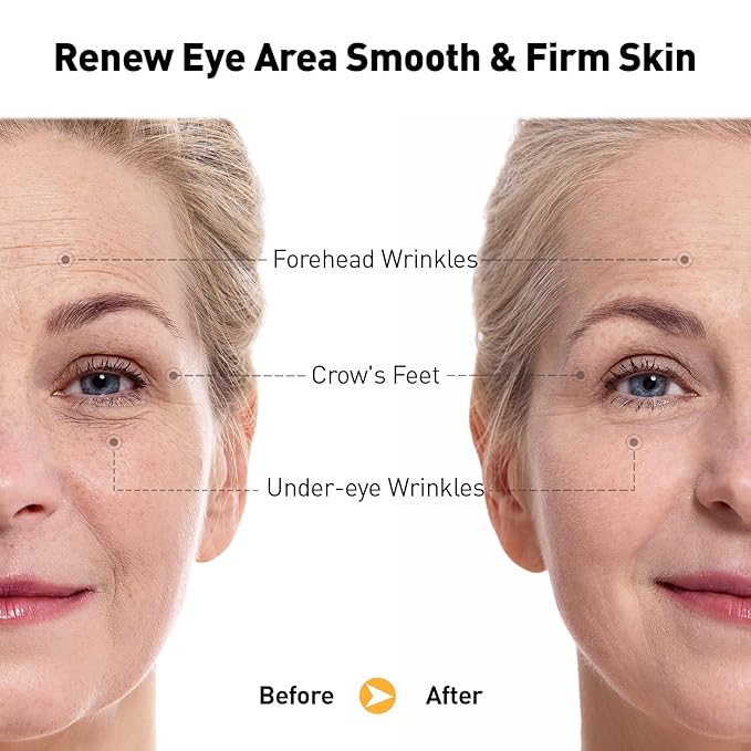 Eye Cream for Anti-Aging & Wrinkles – Firming, Hydrating & Repairing Eye Serum with Retinol, Niacinamide, Hyaluronic Acid, Vitamin E & Bifida Ferment Lysate, 0.7 Fl Oz (Pack of 1)