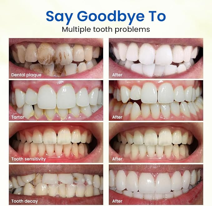 Freshmile Teeth Whitening Powder, Toothpowder Fluoride-Free Hydroxyapatite Formula Enamel Strengthening Gently Cleans & Whitens