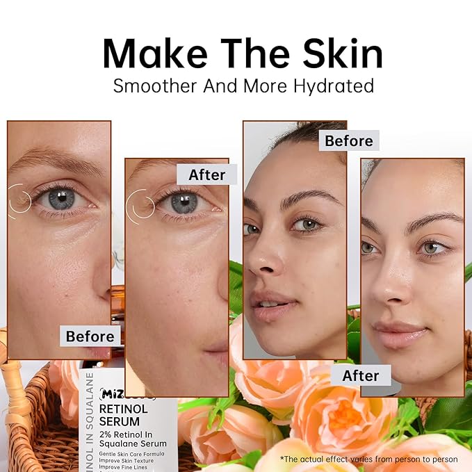 Retinol 2% in Squalane Serum For Face, 30ML Anti Aging Retinol Serum For Fine Lines & Acne, Dry Skin, Moisturizing.