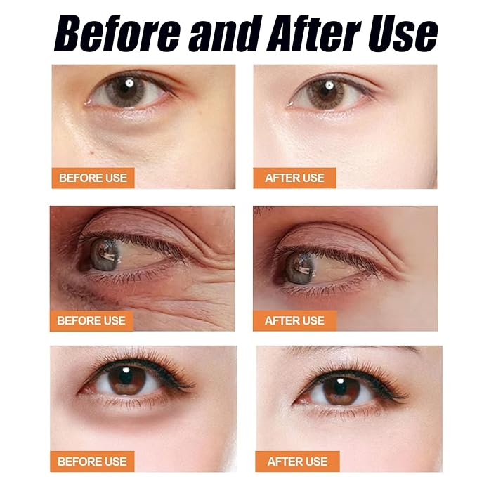 Calcium Multi Balm, Calcium Volume Multi Balm, Wrinkle Core Stick, Korean Collagen Moisturing Stick, Intensive Repair, Keep The Skin Firming Moist and Smooth for Eyes, Neck and Forehead (2)