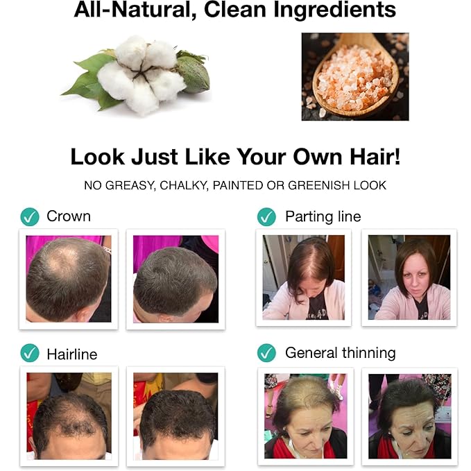 Caboki All-Natural Hair Building Fiber. Make Thin Hair Look 10X Fuller Instantly. Eliminate the Appearance of Bald Spot and Thinning Hair (30G, 90-Day Supply). Medium Brown