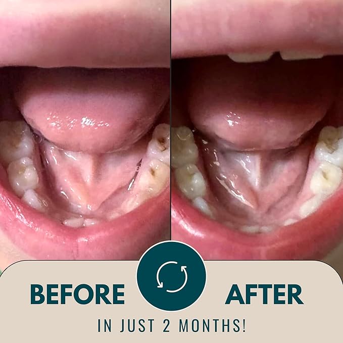 THE TOOTH WIZARD pH Balancing Toothpaste | Natural Strawberry Flavor | Fluoride-Free | SLS-Free | Gentle Whitening | Supports Healthy Oral Microbiome | 3 oz