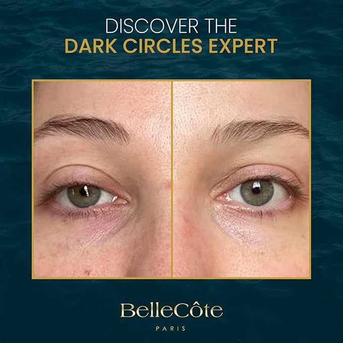 Anti Wrinkle Eye Contour Gel - Eye Gel for Dark Circles and Puffiness, Eye Treatment with Hyaluronic Acid & Vitamin C+E Complex for Dry & Dehydrated Skin Around Eyes, Diminishes Fine Lines | (1 Fl Oz)