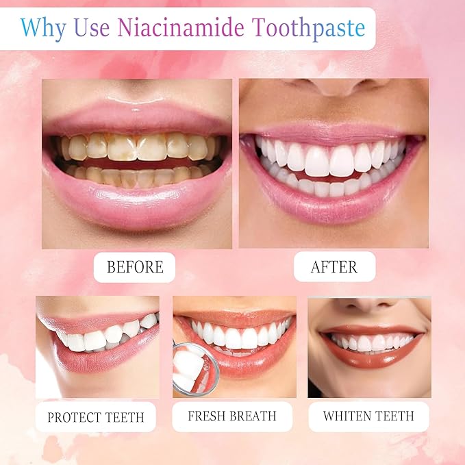 Niacinamide Whitening Toothpaste, Triple White Probiotic Whitening Toothpaste, Fluoride-Free| Sensitivity Relief | Fresh Breath & Stain Removal Formula | Sakura Peach Fragrance (2)