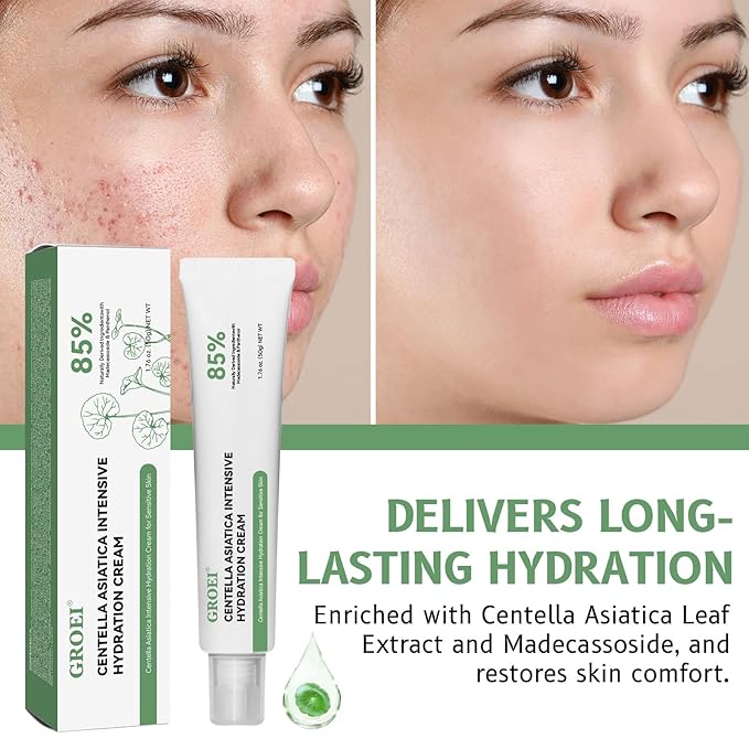 Lucksun Centella Asiatica Cream for Sensitive Skin, 85% Natural Moisturizer, Intensive Hydration & Repair, 50g