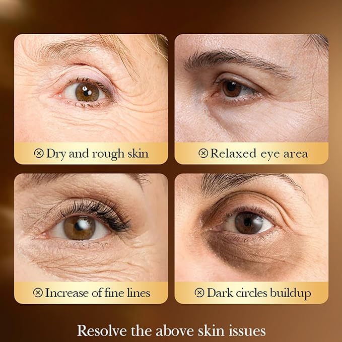 Under Eye Patches (40 Pairs), Under Eye Mask Pads for Puffy Eyes,Dark Circles,Bags & Wrinkles with Collagen & Hyaluronic Acid,Revitalises & Refreshes Skin,Eye Skin Care Gift Set for Men & Women