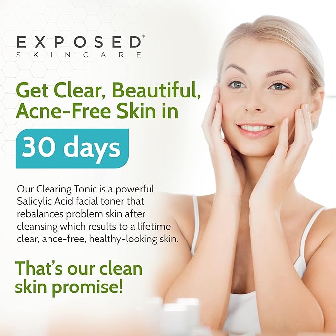 Exposed Skin Care, Clearing Tonic Facial Toner with 1% Salicylic Acid and Witch Hazel – Daily Toner for Teen and Adult Acne, Blackheads and Oily Skin – Natural, Non-Toxic and Cruelty Free