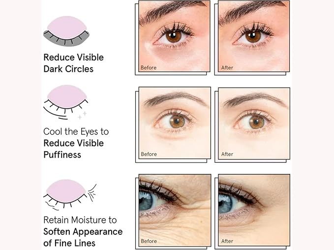 Under Eye Mask - Travel Size Toiletries - Bridal Shower Gifts - Gel Eye Patches for Dark Circles, Puffy Eyes, Wrinkles, Undereye Bags - Vegan - Self Care (6 Pairs, Gold)