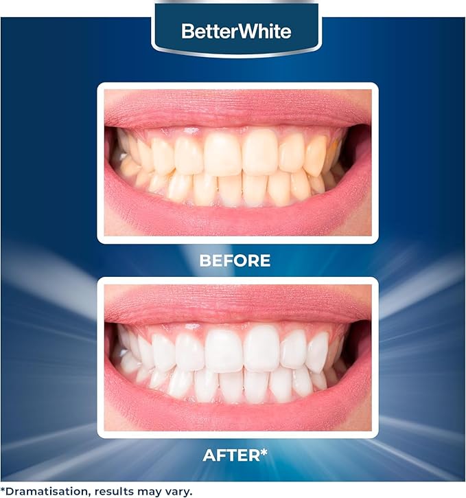 BetterWhite Teeth Whitening Powder - Hydroxyapatite, Remineralizing, Non-Sensitive Formula - Dentist-Approved Tooth Stain Remover & Polisher - Fluoride-Free - 6 Month Supply (40g)