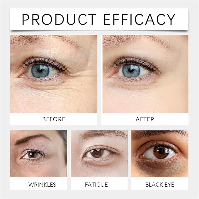 Lutein Eye Essence Oil, Ruy Vc Anti-Wrinkle Eye Serum Oil, Hydrating Under Treatment for Fine Lines, Puffiness & Dark Circles – 15ml (2)