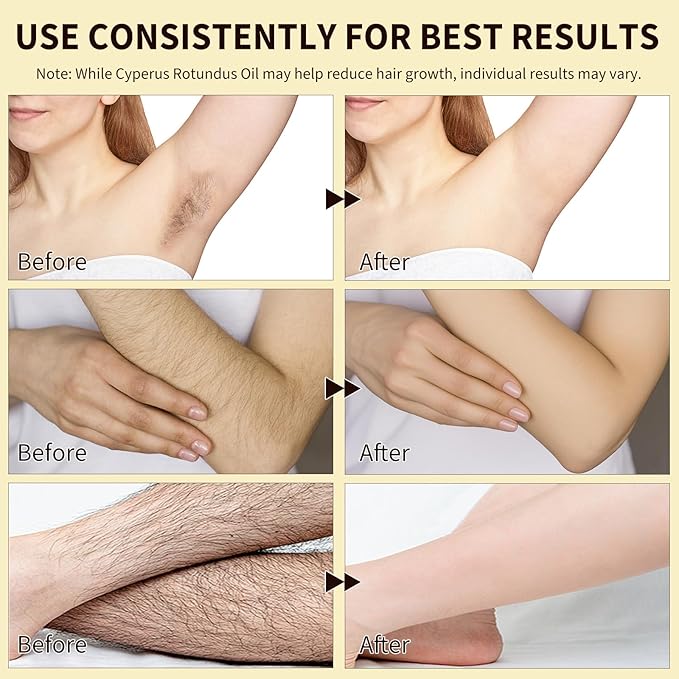 Cyperus Rotundus Oil for Hair Removal, 2PCS 100% Pure Natural Body and Facial Hair Removal for Women, Reduces Unwanted Hair Growth After Shave, Shrink Pores, Hydrates, Soothes and Repairs Skin