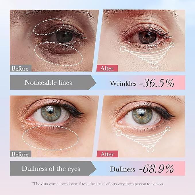 Retinol Eye Cream with 10% Hyaluronic Acid, 30% Retinol, 5% Nicotinamide, 10% Vitamin C for Puffy Dark Circles Wrinkles Eye Bags Fine Lines, Under Eye Cream with 360° Eye Roller Massage Ball