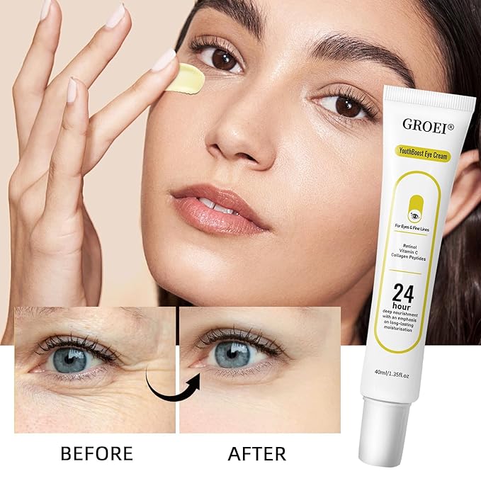 Revive Retinol Eye Cream with Peptide | Anti-Aging Treatment Reduces Wrinkles for Face and Neck, Fine Lines, Firms & Hydrates for All Skin Types | Boosts Collagen, Improves Skin Texture | 1.35oz, 2PCS