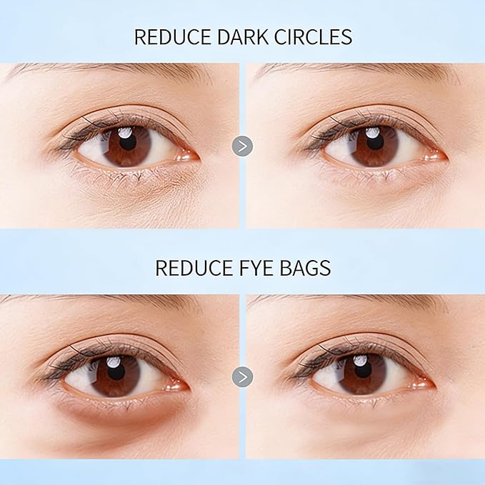 Caffeine Eye Cream with 360° Roller, Depuffing Serum with Caffeine, Collagen, Hyaluronic acid, Hydrating Under Eye Cream Firming Gel Reduce Puffiness, Dark Circle, Fine Lines & Bags, 0.5 Oz