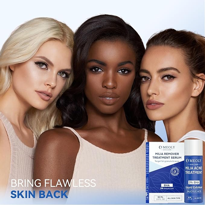 Milia Remover for face and eyes: Milia remover treatment with 3% Salicylic Acid for Acne exfoliant, Advanced formula for Men and Women 30ML