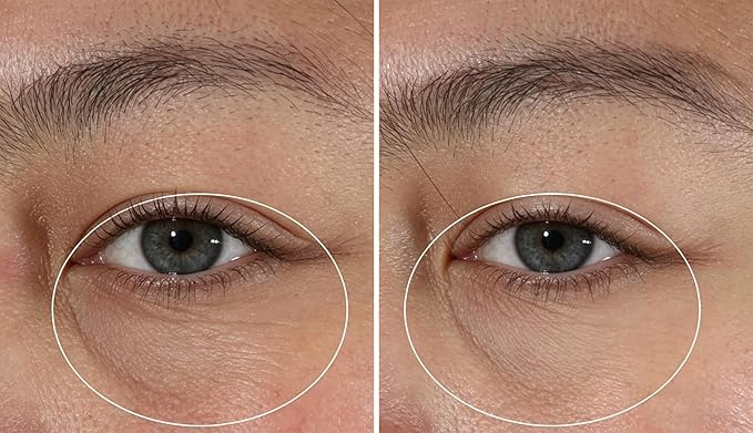 Eye Cream -1pcs