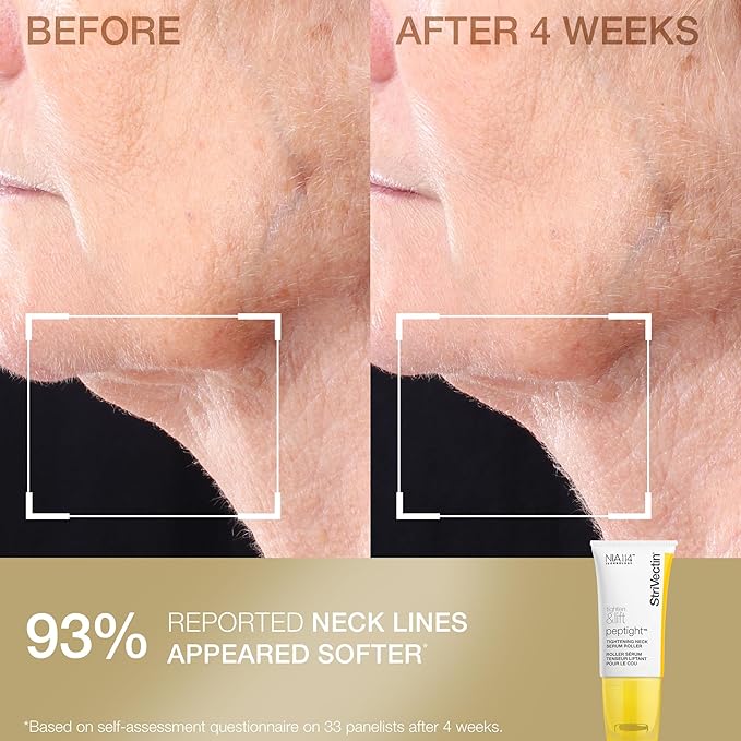 StriVectin Tighten & Smooth Neck Cream and Neck Serum Roller Anti-aging Skin Care 2-Piece Set, Smoothing Look of Wrinkles and Fine Lines, Improves Crepey Skin and Vertical Lines