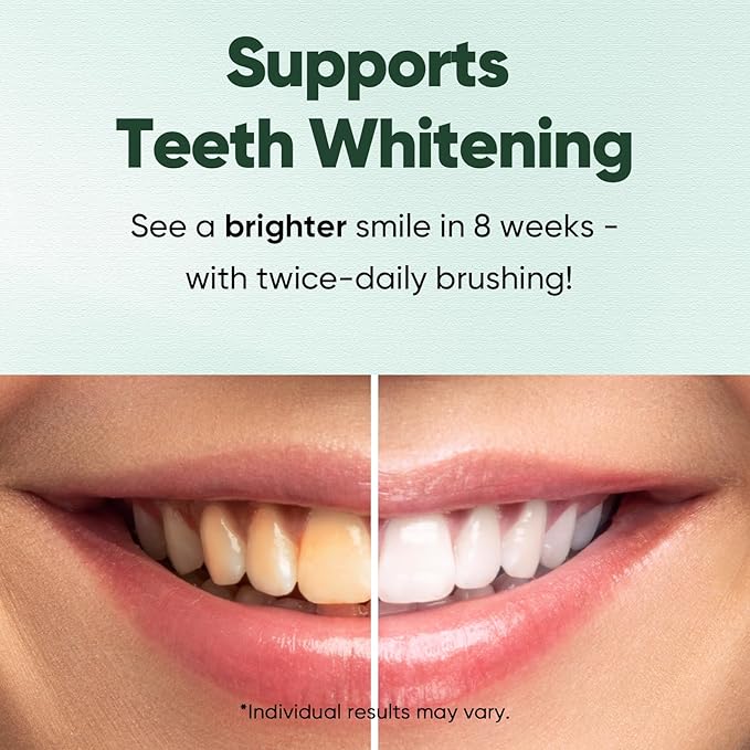 MySmile Teeth Whitening Strips 14 Treatments with Fluoride Free Toothpaste 4.2oz, Infused Hydroxyapatite, Includes Natural Ingredients, Helps Strengthen Enamel, Whiten Teeth, Fresh Mint