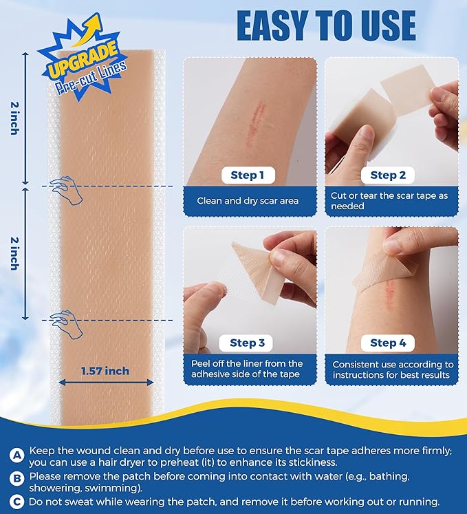 Medical Grade Silicone Scar Sheets & Tape - 1.6”x60" Roll, Ultra Soft, Hypoallergenic Rolls for Surgical, C-Section, Tummy Tuck, Keloid Scars, Stretch Marks & Burn Scar Removal