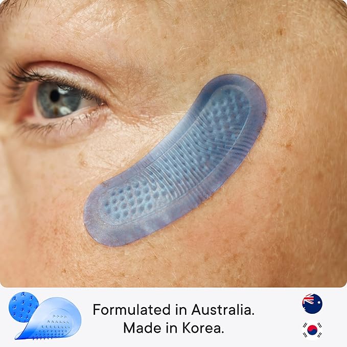 Qure Micro-Infusion Anti Wrinkle Patches for Smile Line, Frown lines, Under Eye Bags, Puffiness, Crow's Feet - Retinol, Caffeine - Dissolvable for Overnight Use - 8 Pairs