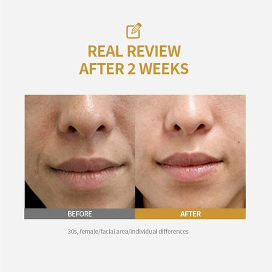 "The Silk Thread Secret: Is a Facelift in a Bottle Finally Real?"