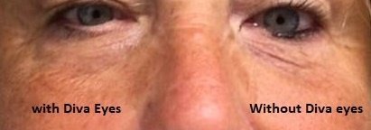 Diva Eyes, Tightens, Lifts& Repairs Areas Around The Eyes, with Cucumber Extract, Hyaluronic Acid, Aloe and Fission Instant Lift By Diva Stuff