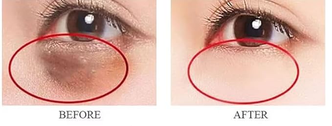 New 2026, Roliac's INSTANT Eyes & Face lift Wrinkle remover Cream, instant results, 25 LARGE 1 ml. (0.34 onces) per Viales, No white residue, Guaranteed results, Anti-aging solution, Last all day.