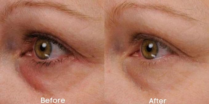 Replere - Renew & Firm Eye Serum