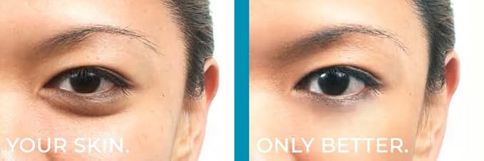 BE YOU SKIN | Skin Perfecting Conceal | RADIANT