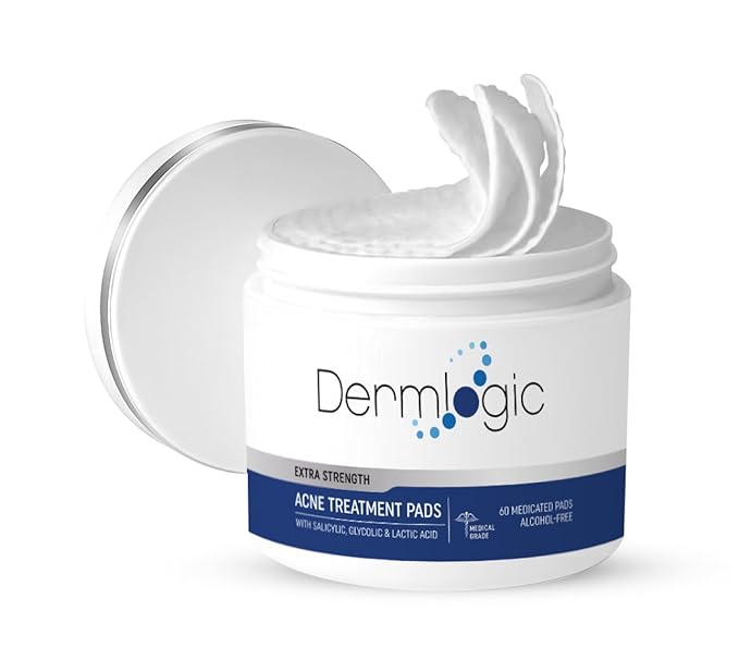 Acne Treatment Pads- Contains Salicylic, Glycolic, & Lactic Acid for Face & Body. Clears Away Clogged Pores, Oily Skin & Cystic Breakouts. Removes Dark Spots, Blackhead & Whitehead Pimples