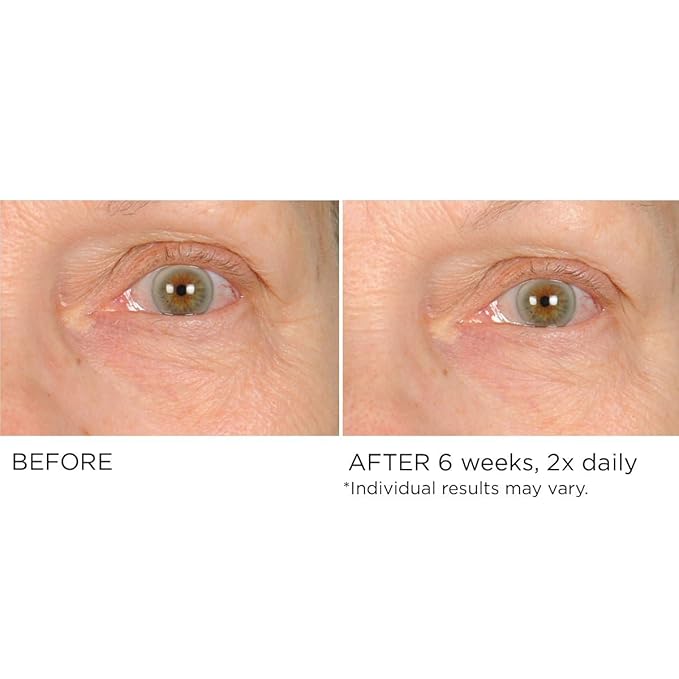 NASSIFMD Under Eye Smoother Firming Cream, Anti-Aging Eye Cream for Dark Circles, Puffiness & Wrinkles