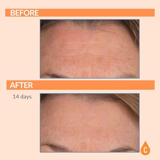 Serious Skincare - Vitamin C Broad Spectrum SPF 30 Sunscreen Moisturizer for Face, Hydrates Dry Skin, C3 Esters Anti-Aging Wrinkle Cream with Collagen, Radiant Skin, Daily Use, No White Cast 2 Fl. Oz.