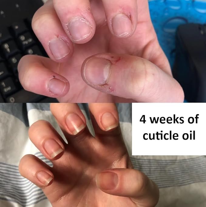 MAVALA Cuticle Oil Nail Care| Sulfate & Paraben Free | Cuticle Softener | Moisturizes Nail Bed | Improve Nail Appearance | Encourage Nail Growth | 0.3 Ounce