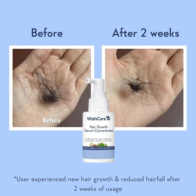 WishCare Hair Growth Serum Concentrate - Rosemary, 3% Redensyl, 4% Anagain, 2% Baicapil, Caffeine, Biotin, Plant Keratin & Rice Water