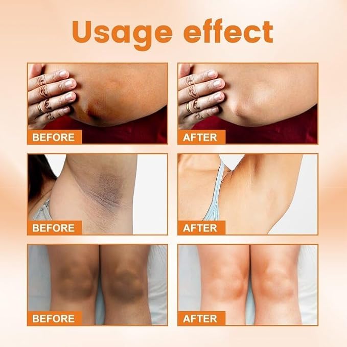 Body VVhitening Cream for Private Area and Bikini Area, Quick Results Vitamin C Skin Care Cream for Underarm, Neck, Armpit, Elbow, Knees and Inner Thigh (1.8 FL.Oz)