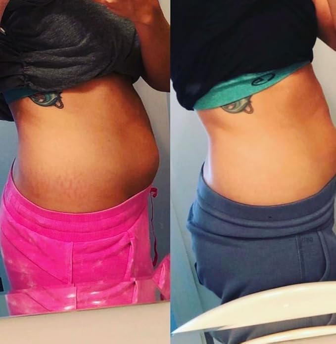 Promise Stretch Mark Prevention Kit, Scars and Dry Skin, Ultra-Hydrating Stretch Mark Cream and Stretch Mark Oil for Pregnant Women, Vegan, Non-Toxic, Set