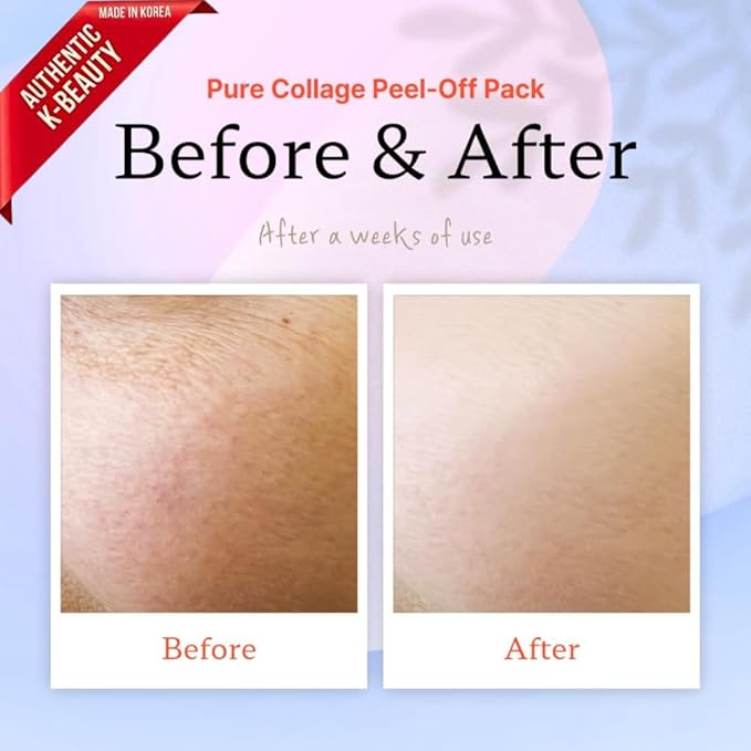 ELT Collagen Peel Off Face Mask Pack - Korean Wrapping Face Peel Mask - Hydrating & Firming Facial Mask with 5 Types of Collagen, 8 Peptides, Silicone Brush Included (60 ml / 2.02 fl.oz)