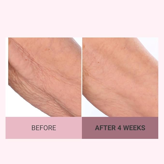 Consult Beaute Champagne Lift Hydrating Firming Body Cream with Pink Pepperslim, Tightens, Tones Crepey Skin, Moisturizer for Dry Skin, Warm Santal, 8 oz.