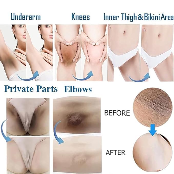 Skin Whitening Cream Bleaching Cream for Body Intimate Area, Private Parts, Underarm, Knees, Elbows, Inner Thigh, Bikini Areas, Bikini Line, Skin Lightening Dark Spot Remover For Intimate Areas 60ML