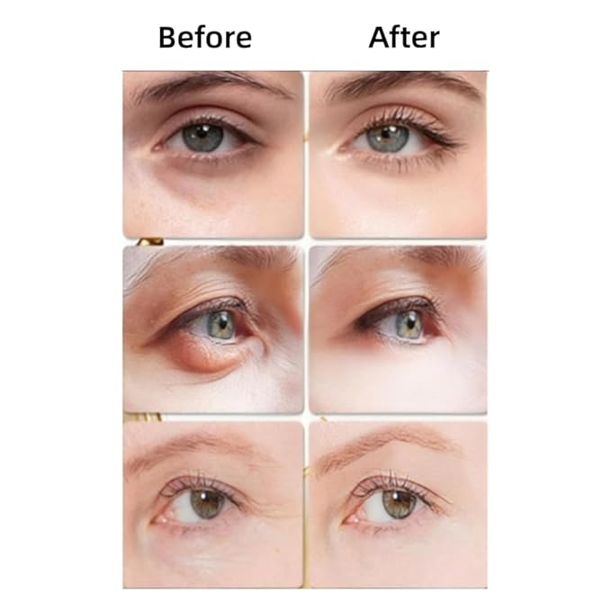 Snake Peptide Eye Cream with Massage Roller, Caffeine Reduce Eye Wrinkles Dark Circles, Anti-Aging Eye Cream for Dark Circles, Puffiness & Wrinkles, Hydrating