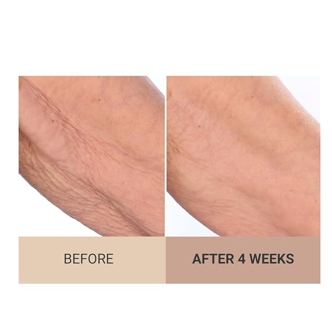 Consult Beaute Unscented Champagne Lift Hydrating Firming Body Cream with Pink Pepperslim, Moisturizer, Tightens Crepey Skin, Tones & Hydrates Dry Skin on Arms & Legs - 8 oz.