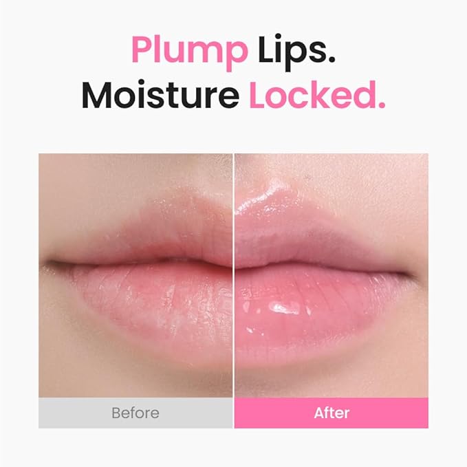 [SKIN&LAB] 3D PDRN X Collagen Lip Serum, Contains PDRN, Bakuchiol, Collagen, Plumping Effect, Smooth & Bouncy Lips, Deep Hydration – 0.35 fl. oz