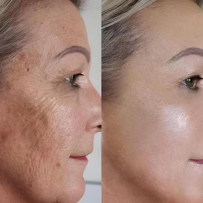 AHA 30% + BHA 2% Peeling Solution, Chemical Peel for Face at Home, BHA Liquid Exfoliant for Large Pores, Wrinkles & Fine Lines, 1.0 FlOz (1 PCS)