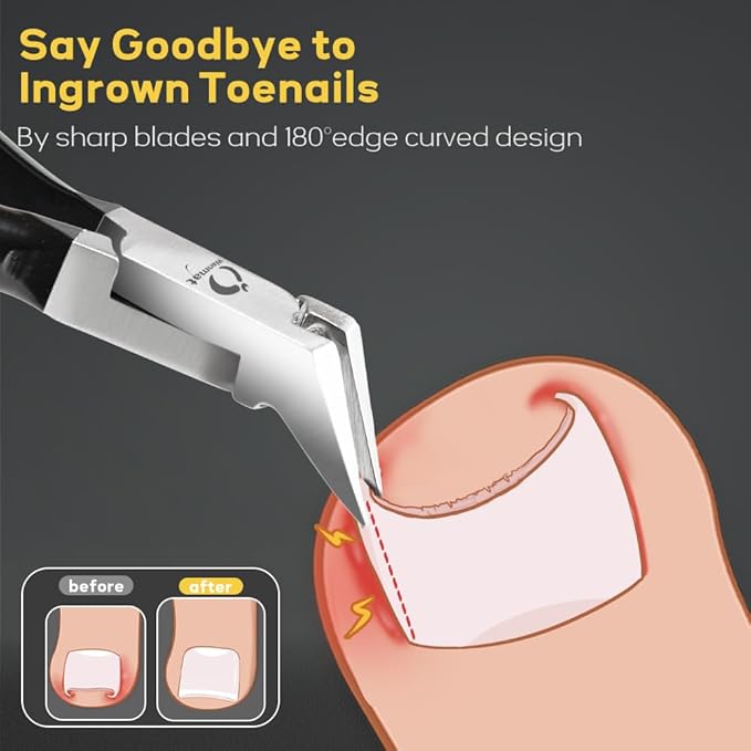 Wanmat Toenail Clippers, Professional Thick & Ingrown Nail Clippers for Men, Pedicure Clippers Toenail Cutter, Upgraded Toe Nail Clippers with Catcher and Non-Slip Handle