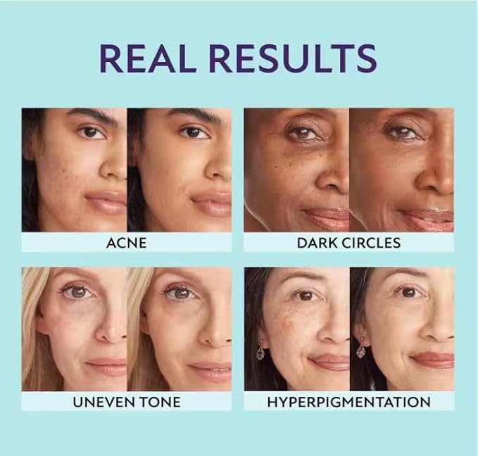 Supreme Radiance All-in-One Beauty Cream - Long-Lasting CC Cream Foundation - Waterproof and smudge-proof, infuses skin with a dewy, luminous glow (Light)